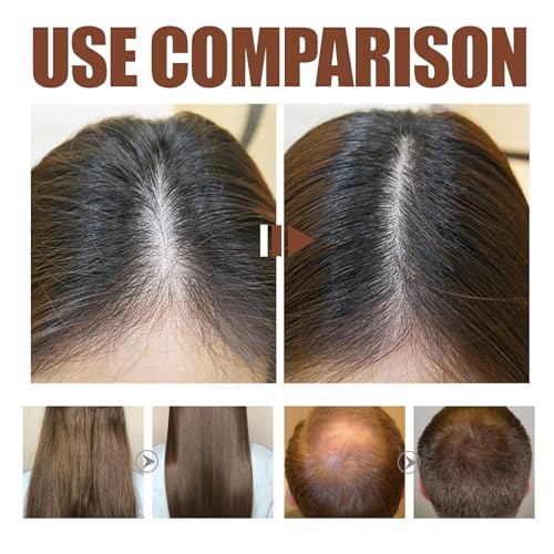 Onion Hydrosol Shampoo for Hair Growth with Rosemary & Biotin - 10oz