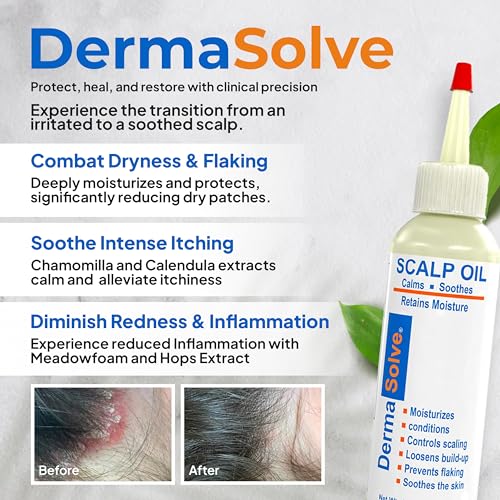 Dermasolve Psoriasis & Dandruff Scalp Oil for Itch Relief