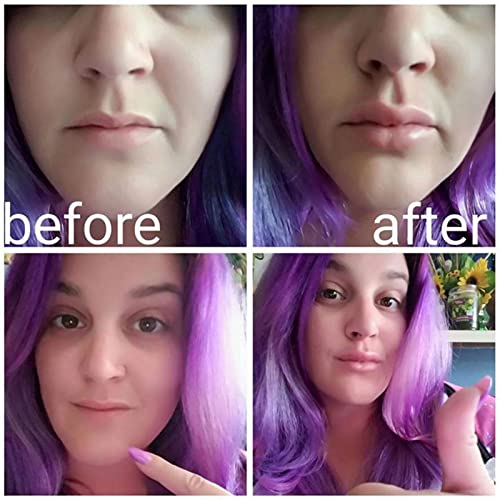 Soft Silicone Lip Plumper Device for Fuller, Thicker Lips