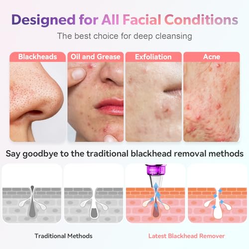 Pore Vacuum Blackhead Remover with 5 Suction Levels & Probes