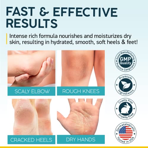 NUVADERMIS Urea Cream & 35% Glycolic Acid Pads - 40% Urea Foot Repair Lotion - Hand Dry Skin Callus Remover - Exfoliating Facial Peel - Natural Resurfacing for Sensitive Skin - 60 Double-Side Pads