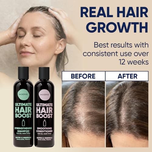 Hair Growth Shampoo and Conditioner Set for Men & Women