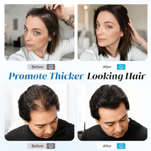 Hair Growth Serum Roll-On | Caffeine & Rosemary for Thinning Hair