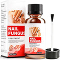 Chamex Extra Strength Toenail Fungus Treatment with Natural Extracts