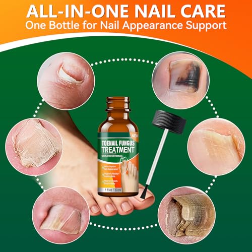 Nail Care Solution by Auensten