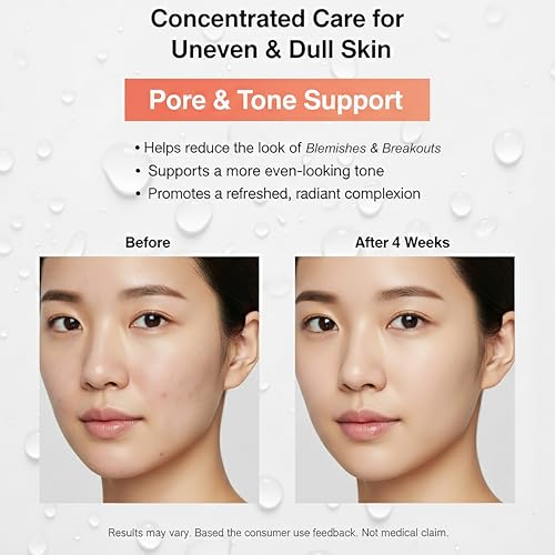 15% Niacinamide Serum for Face - with Vitamin C, Glutathione - Korean Dark Spot Serum for Uneven Tone, Enlarged Pore, Dullness, Ance-Prone, Sensitive Skin - Fragrance-Free, Daily Use