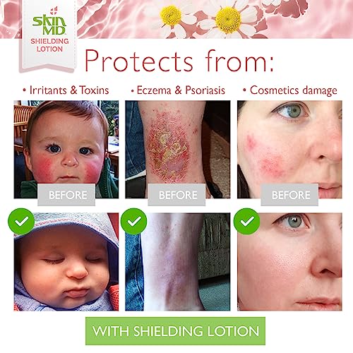 Skin MD Shielding Lotion 8oz - Hydrating Body Lotion for Sensitive Skin with Dispenser | Non-Greasy, Fast-Absorbing Moisturizer with Plant-Based Ingredients for Dry Skin, Eczema & Psoriasis Relief