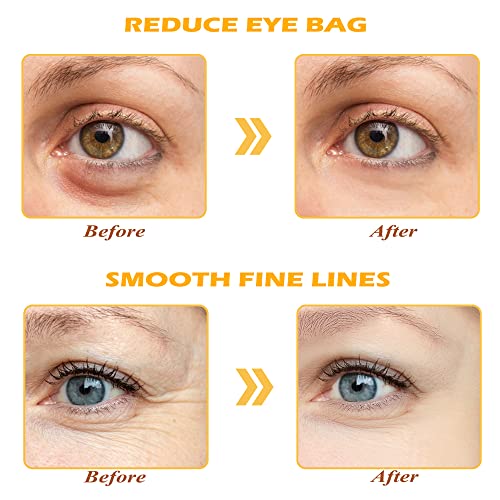 24K Gold Eye Mask, 30 Pairs Under Eye Masks for Dark Circles and Puffiness Treatment, Under Eye Patches for Puffy Eyes and Eye Bags, Gel Eye Mask Eye Pads for Face Skin Care