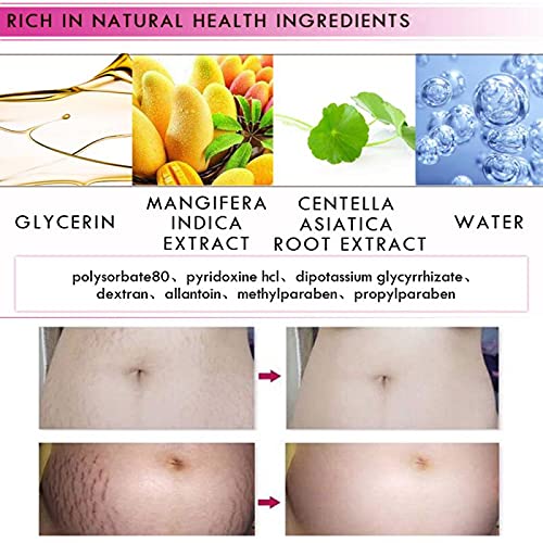 Mango Stretch Mark & Scar Removal Cream 40g