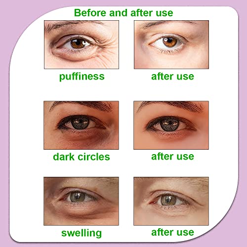 Reusable Hot Cold Eye Pads for Puffiness Relief (4 Pack)