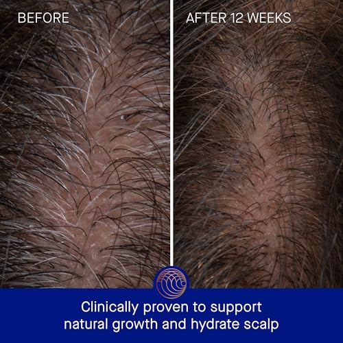 Augustinus Bader Scalp Treatment for Healthy Hair Growth