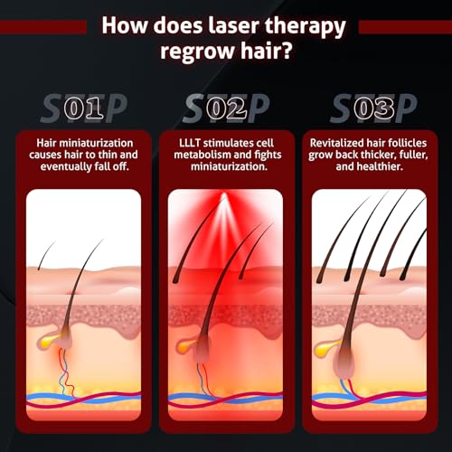 Laser Hair Growth Cap - 108 Red Light LEDs, Wireless