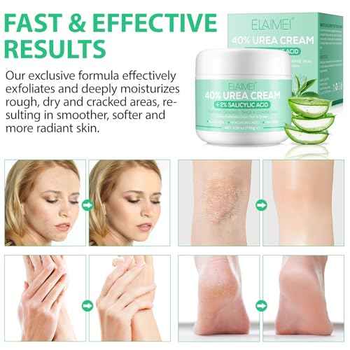 Urea Cream 40 Percent for Feet - 40% Urea Cream Plus 2% Salicylic Acid with Hyaluronic Acid,Tea Tree, Aloe Vera for Dry Cracked Heels, Knees & Maximum Strength Foot Deep Moisturizer(5.29 OZ)