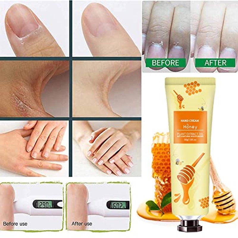 10-Pack Natural Hand Cream for Dry Cracked Hands