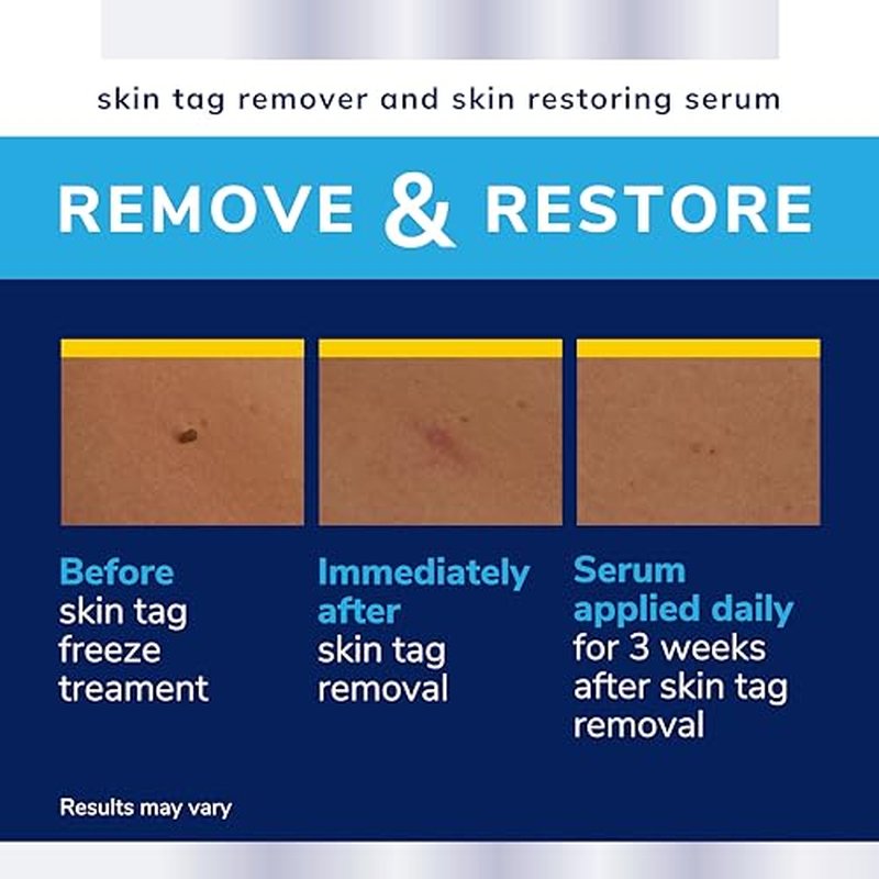 Dr. Scholl's Skin Tag Remover Kit, 12 Count with Serum