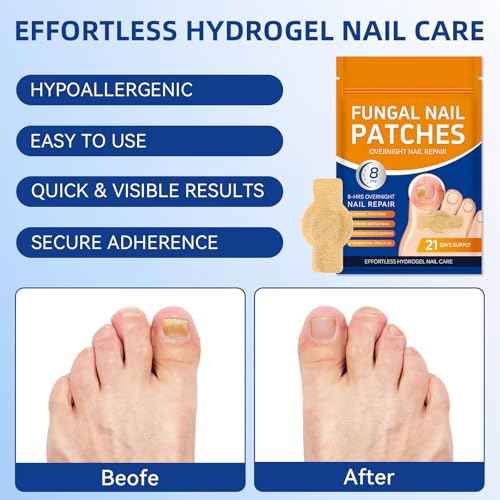 Nail Patches Toenail Treatment Extra Strength, 8-Hour Overnight Nail Fast Acting Repair Effortless Hydrogel Nail Care and Repair for Damaged Nails Overnight Renewal 21 Patches