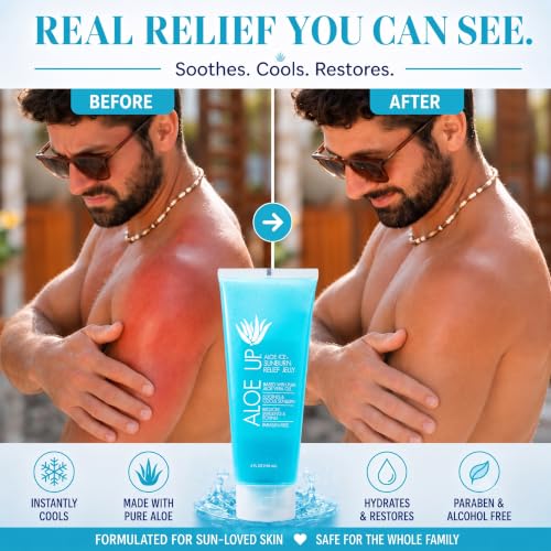 Aloe Up Pure Aloe Vera Gel 4oz - After Sun Sunburn Relief