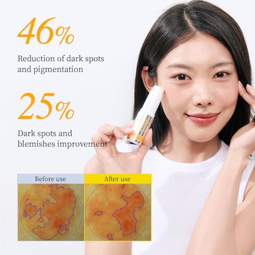 YADAH Vitamin C 30 Eye Correcting Balm (0.35oz) All-in-one Multi Care for Dark Spot Remover, 30% Pure Ascorbic Acid & Vitamin E for Radiant Nourished Skin Starter & Finishing Balm and Skin Brightening