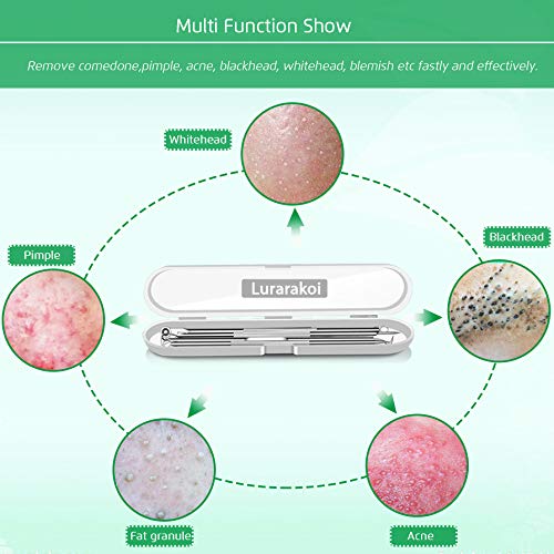 5-Piece Blackhead Remover Kit, Professional Stainless Steel Comedone Extractors