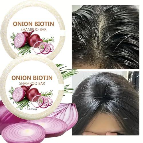 Onion Biotin Shampoo Bar for Hair Growth & Loss (2-Pack)