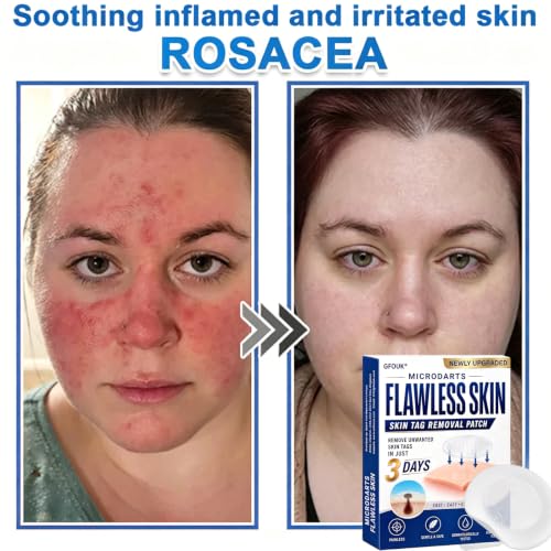 FKMEE Hydrocolloid Patches for Face & Body - 9 Count