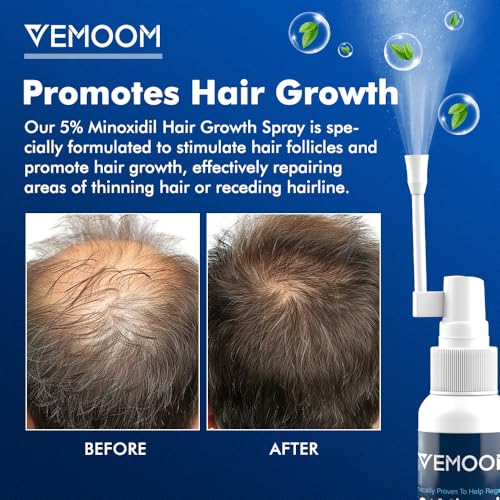 5% Minoxidil Hair Growth Spray for Women & Men - 60ml, Extra Strength Treatment for Thicker, Stronger Hair