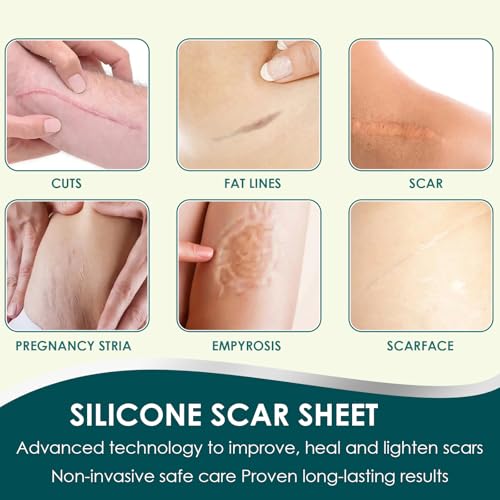 Silicone Scar Tape, Premium Silicone Gel Scar Sheets (1.6"x 60" Roll-1.5M), Reusable Silicone Patches, Soft Silicone Tape for Surgeries Scars, C-Sections, Wrinkles et