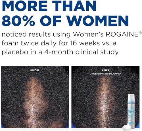 Rogaine 5% Minoxidil Foam, Topical Once-A-Day Hair Loss Treatment for Women to Regrow Fuller, Thicker Hair, Unscented, 2-Month Supply, 2.11 oz