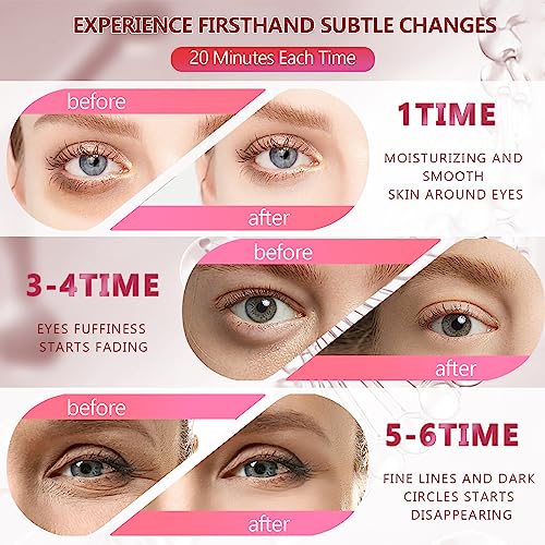 2 Packs 60 Pcs Under Eye Patches, 24K Gold+Pink, 30 Pairs Women Undereye Mask for Puffy Eyes Dark Circles Treatment, Men Collagen Gel Pads Hydrating for Eye Bags Puffiness Wrinkle, Beauty Skin Care