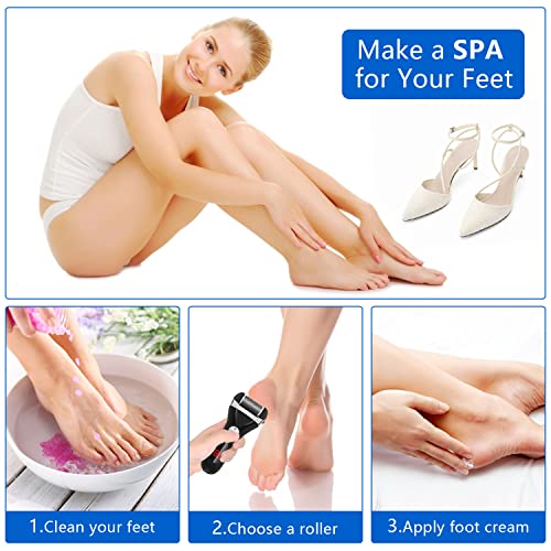 Electric Foot Callus Remover Kit with Rechargeable Battery & 3 Roller Heads for Dead Skin Removal