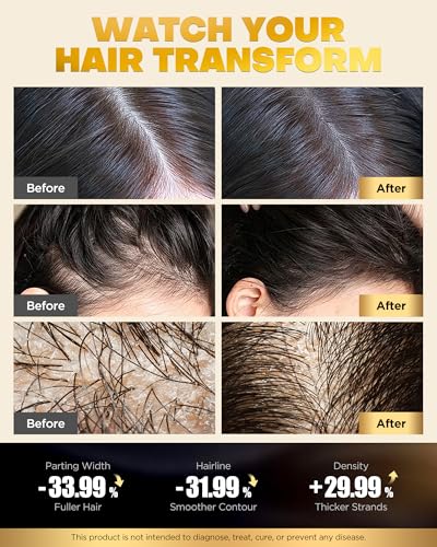 Biotin Hair Growth Shampoo and Conditioner Set - 2x16.9oz