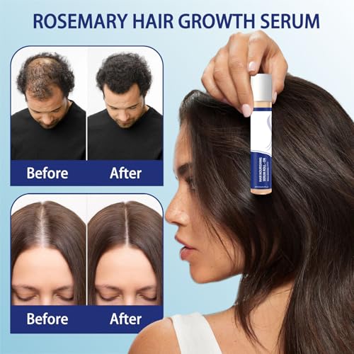 Hair Growth Serum Roller 25ml - Rosemary & Ginger for Thicker Hair