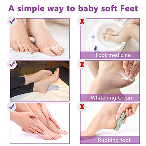 ALIVER Exfoliating Foot Peeling Mask 5-Pack - Lavender Foot Peel Socks