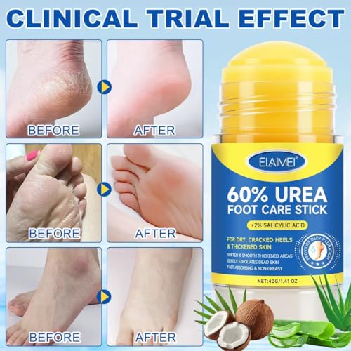60% Urea Cream Stick with 2% Salicylic Acid Foot Balm - 2 Pack (1.4 oz)
