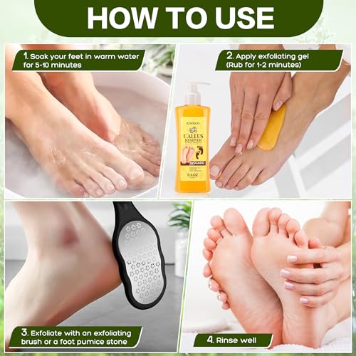 Foot Callus Remover Gel Kit with Foot Files for Smooth Feet
