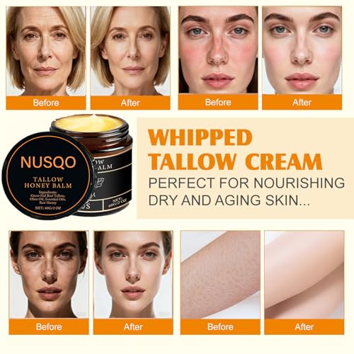 Organic Grass-Fed Beef Tallow Balm with Raw Honey - Moisturizing Cream for Soft, Smooth Skin - Tallow and Honey Balm for Face,Natural Formula for Dry & Sensitive Skin (2)