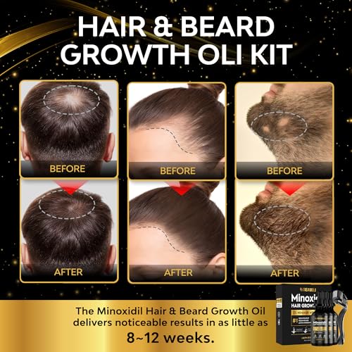 Beaueli 3-Pack Minoxidil Beard & Hair Growth Kit 2 Fl Oz for Men & Women