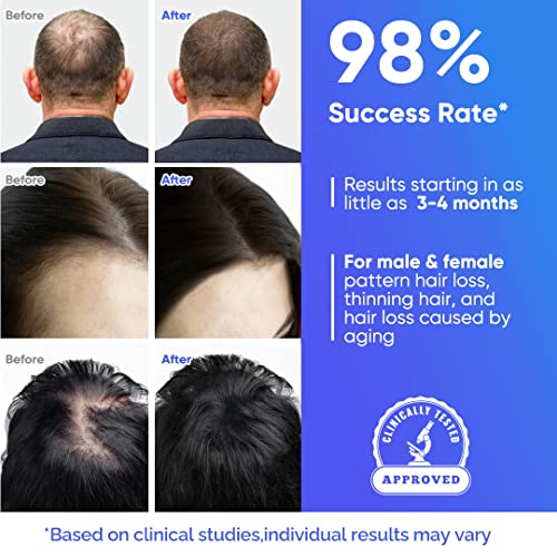 Hair Growth Cap - Hair Loss Treatment for Androgenetic Alopecia,Low Level Laser Therapy FDA Cleared Hair Loss Treatment for Men & Women Black 1 1.0 Count 250.0 grams