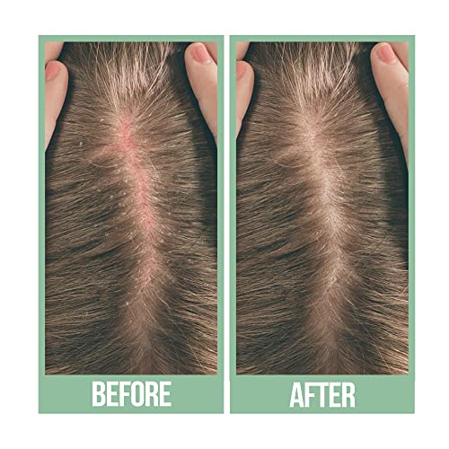 Difeel Scalp Care Tea Tree Premium Natural Hair Oil - Tea Tree Oil 8 oz.