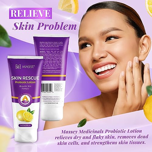 Massey's Skin Rescue Probiotics Lotion - Daily lotion for Men & Women - Refreshing Lemon Scent - Non-Greasy Moisture for Smooth & Sensitive Skin - 3.4 oz