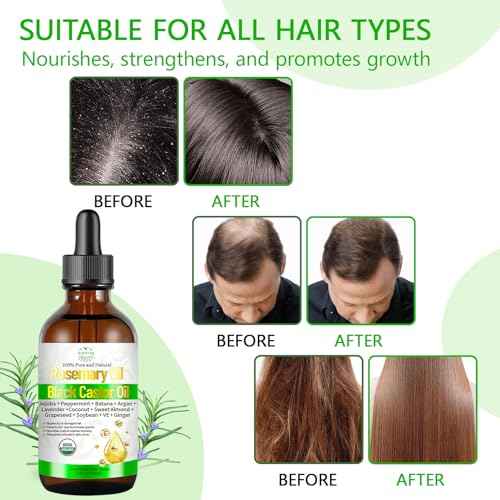 Organic Rosemary Oil for Hair Growth, Rosemary Oils with Castor ? USDA Certified Cold Pressed Blend Hair Oil for Thicker, Fuller Hair, Soothe Itchy Scalp & Repair Damaged Hair ? 4 fl oz
