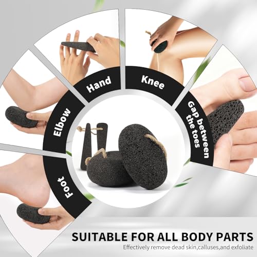 ÖkoStamm 4-Piece Natural Volcanic Pumice Stone Set for Feet Callus Removal