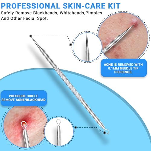 Stainless Steel Pimple Extractor Tool 2-Pc Set Blackhead Remover