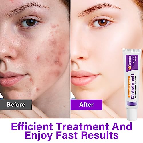 Atrilly Azelaic Acid Serum, Azelaic Acid 12% Facial Cream, Hyaluronic Acid & Niacinamide for Redness Relief Face, Dark Spot, Rosacea Acne, Balance Excess Sebum