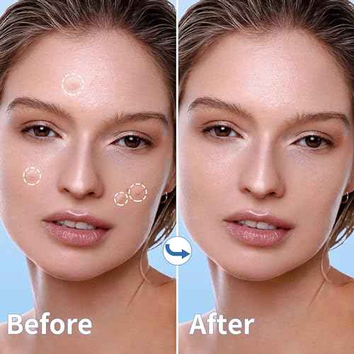 Pimple Patches for Face - 3 Size 510 Counts Hydrocolloid Acne Patches for Covering Zits and Blemishes, Spot Stickers with Salicylic Acid, Tea Tree Oil & Calendula Oil(8mm,10mm,12mm)