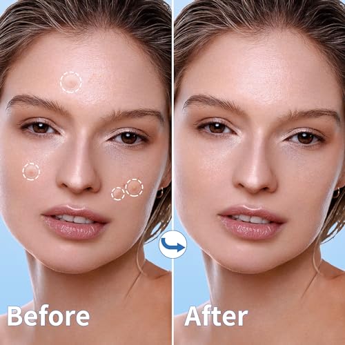Pimple Patches for Face - 3 Size 510 Counts Hydrocolloid Acne Patches for Covering Zits and Blemishes, Spot Stickers with Salicylic Acid, Tea Tree Oil & Calendula Oil(8mm,10mm,12mm)