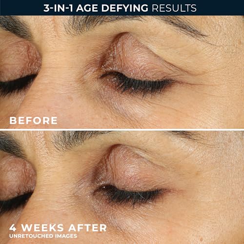 RoC Retinol Correxion Eye Cream - Dark Circles & Wrinkles