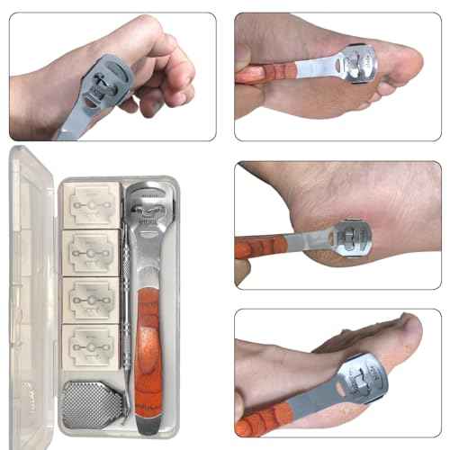 43 Pcs Callus Shaver for Feet Set, Foot Callus Shaver, (1 Stainless Foot File &1 Foot File Heads & 40 Replacement Slices Blades & 1 Nail Cleaning)