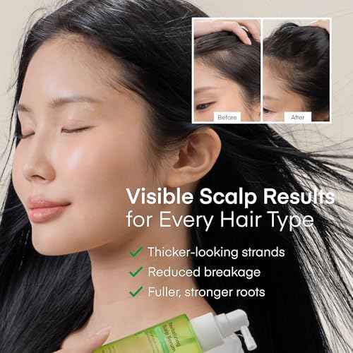 Scalp Serum for Hair Growth Spray ? Korean Vegan Treatment for Hair Loss, Thinning & Itchy Scalp, Non-Greasy, Lightweight Formula to Exfoliate Dandruff & Strengthen Roots ? For Men & Women (100 mL)