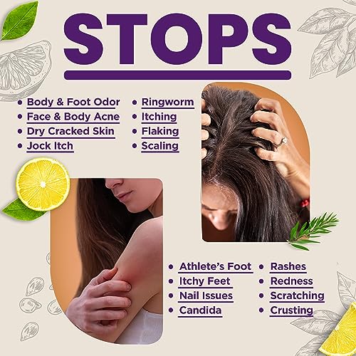 Massey¡¯s CF 100% Natural Probiotic Soap - Lemon and Lavander Body Soap - Sensitive Skin Face Wash with AcneZero Skin Cleanser